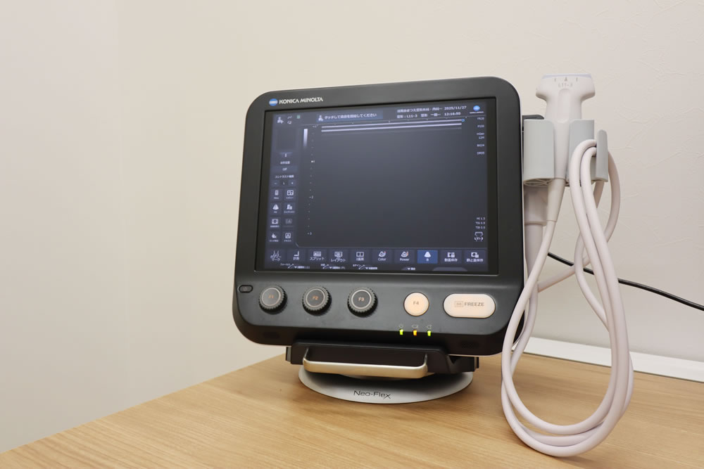 超音波診断装置